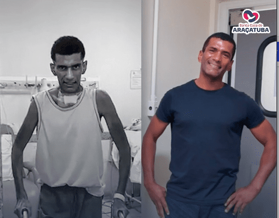 Da sentença de morte ao reencontro com a vida: motorista vence doença rara e emociona equipe da Santa Casa de Araçatuba